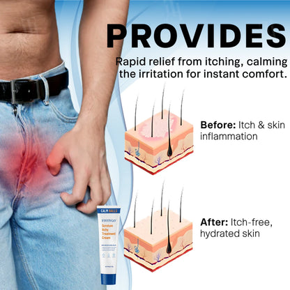 Natravor® Scrotum Itchy Treatment Cream